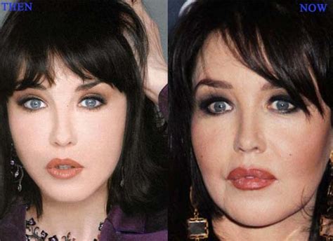 isabelle adjani before surgery.